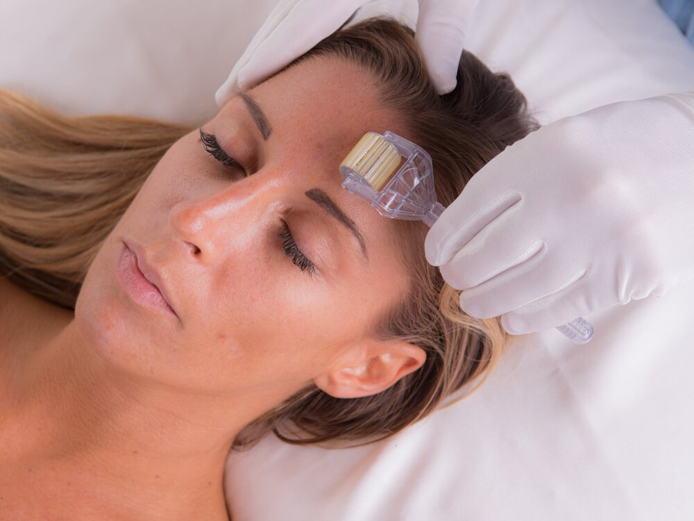 At Home Surrey Microneedling | Glow Bright Med Spa