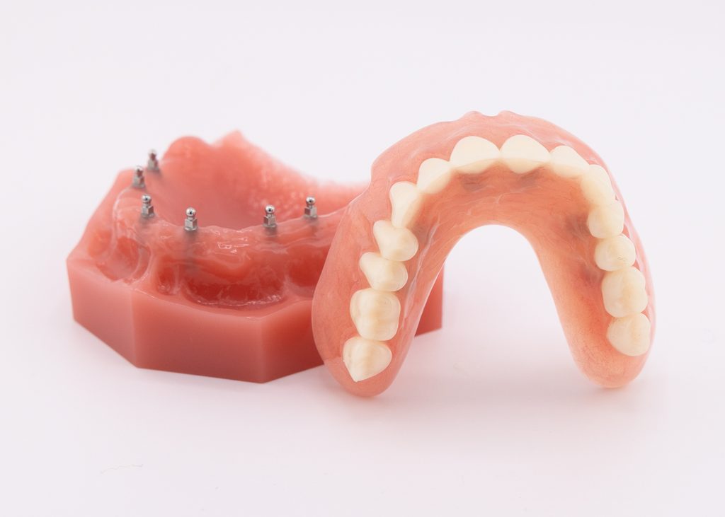 Snap-in dentures near me
